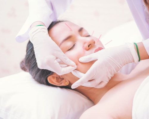 Treatment-for-Facial-Paralysis